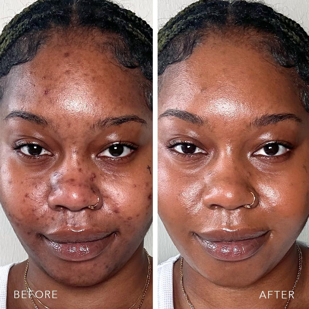 DOLL 10 NO. Doll 10 TCE Liquid Filter - Covers, Blurs, and Brightens (Deep)