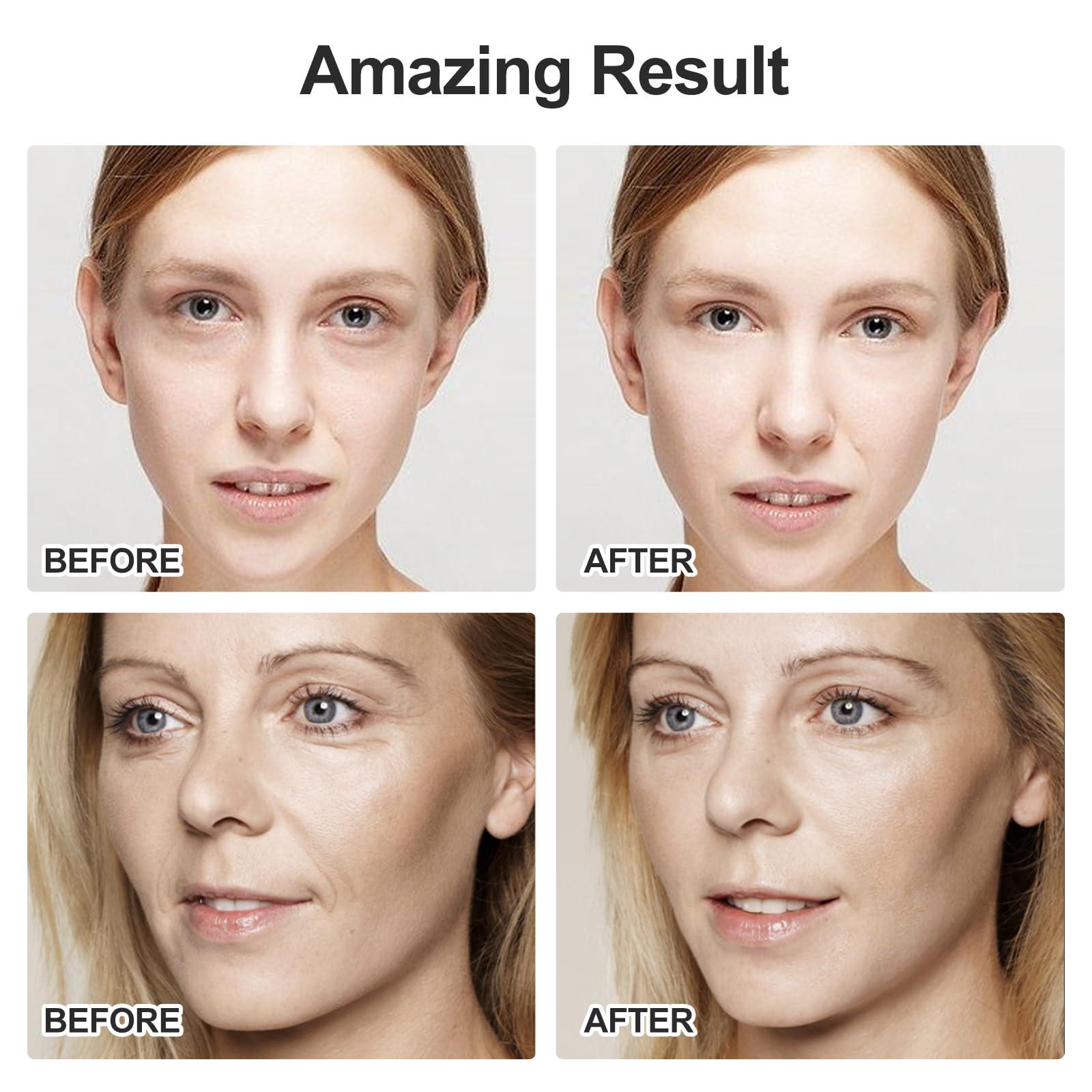 ZminRN ZminRN Terahertz Gua Sha Facial Tools Guasha Tool for Face Body Gua Sha Stone Lymphatic Drainage Massager