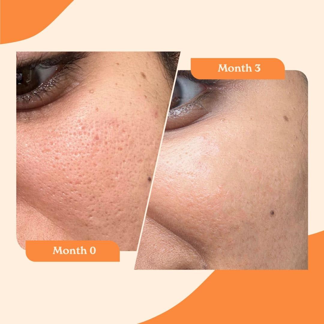 Better Alt Better Alt Kesar Face Mask for Nighttime Skin Care Ritual| with Turmeric, Saffron, Niacinamide, Green Tea Extracts| For Intense Hydration & Radiant Glow|100% Vegan & Cruelty Free, 50 ml