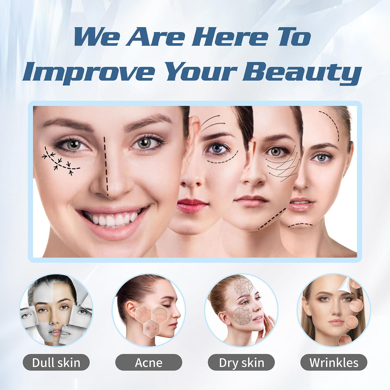 Habodd Pdo Cog Threads 19G100MM, Cog Threads Face Lift Bullet Blunt 10Pcs Pdo Threads Lift for Face/Body 360R Bi-direction Barb Lifting Cog 6D Type