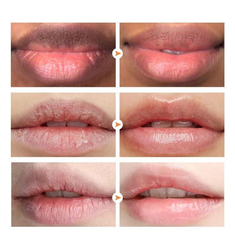 MeXmoB Magic Lip Lighten Scrub Dark Black Lip Removal Exfoliation Pigmentation Fade Dull Pink Lip Balm Brighten Anti-Crack Moisturizing