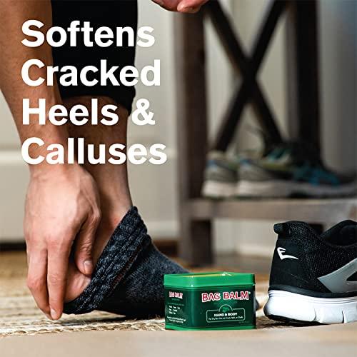 Bag Balm Bag Balm Vermont's Original Hand Moisturizer, Hand Balm for Dry Skin, Cracked Hands, Heels & Dry Hands Treatment, For Dogs and More Ointment, Lotion - 8oz Tin, 3 Pack