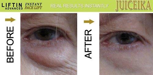 Juiceika "LIFTIN Advanced" INSTANT FACE LIFT by Juiceika. This is an INCREDIBLE 60 Second FACE LIFT!