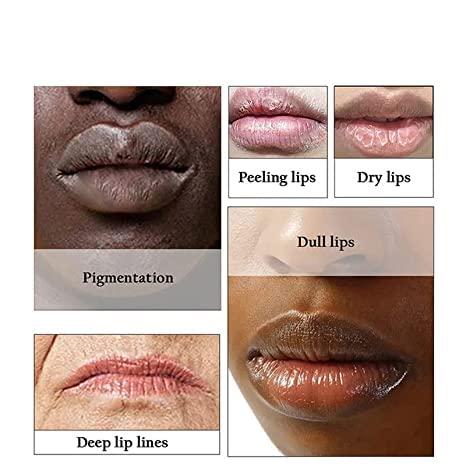 MeXmoB 2pcs Lip for Dark Lips Lip for Smokers Dark Lip Treatment Cream for Pink Lips Lip for Smoker Lips Lip balm for Men and Women (Yellow)