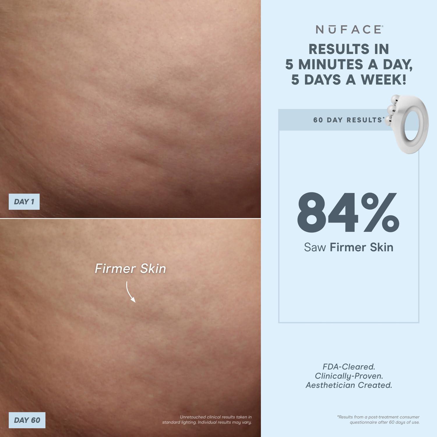 NuFACE NuFACE NuBODY Toning Device - FDA Cleared Microcurrent Device for All-Over Contouring, Firming & Skin Tightening