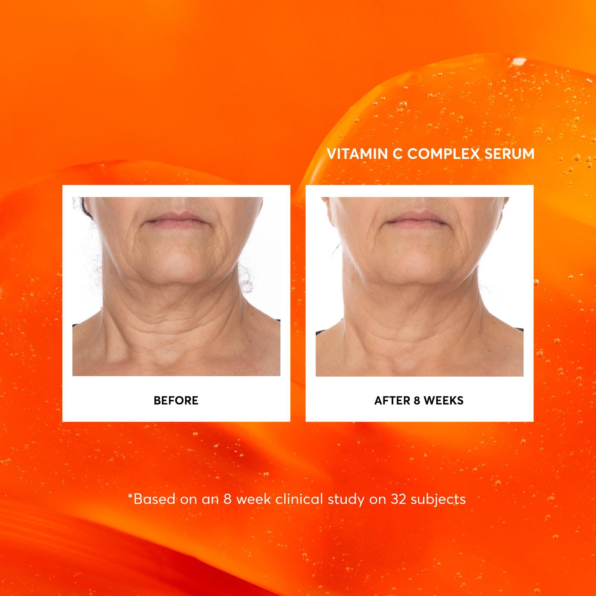 Naturium Naturium Vitamin C Complex Face Serum Jumbo, Anti-Aging Facial Treatment with Hyaluronic Acid & Vitamin E, 2 oz