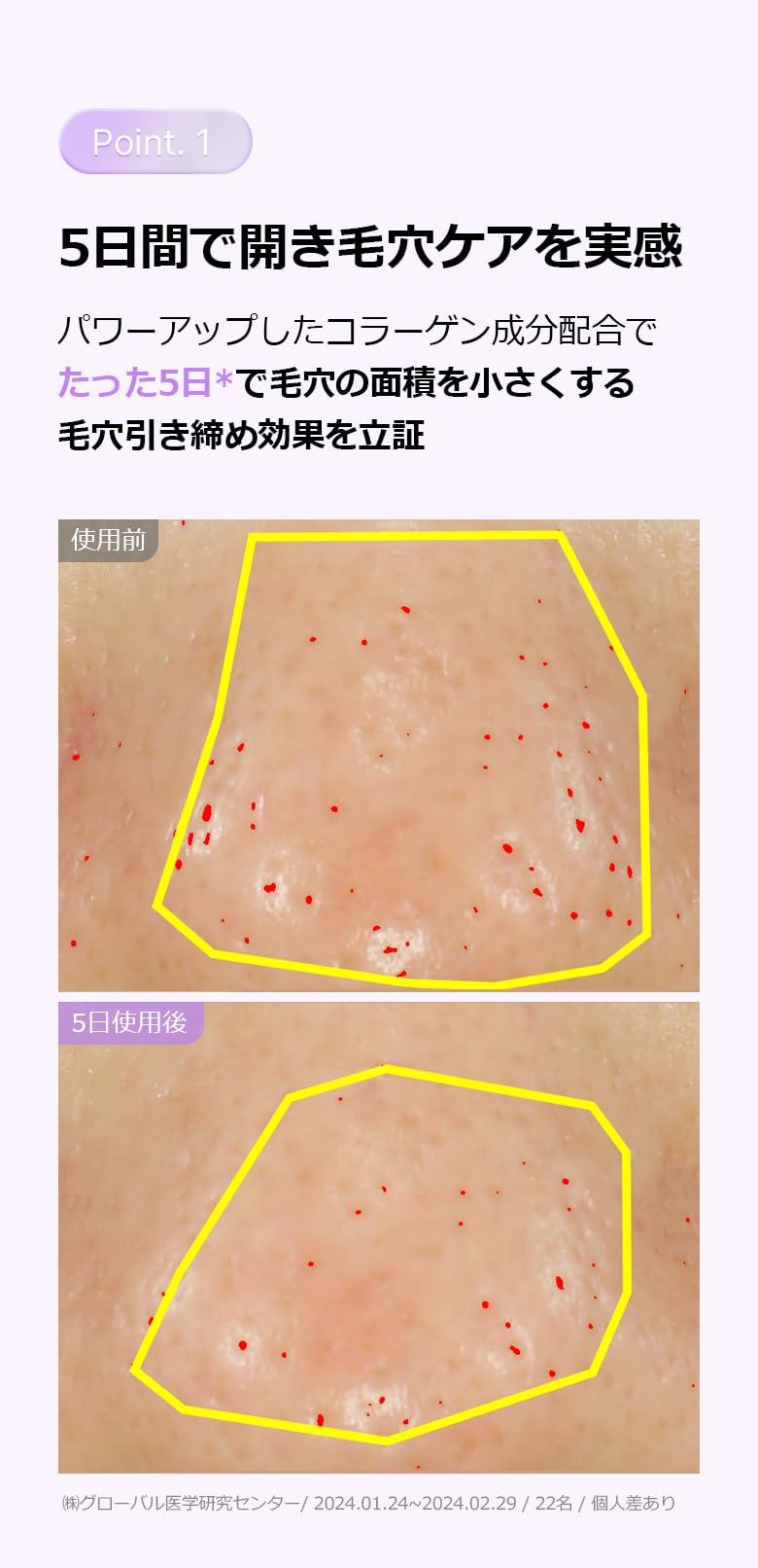 BIOHEAL BOH BIOHEAL BOH Probioderm Collagen Remodeling Serum 1.01 fl oz (30 ml) | Skin Firming Serum with Collagen & 12 Peptides for Pore Tightening & Smoothing | Hydrating & Lifting for Daily Skincare