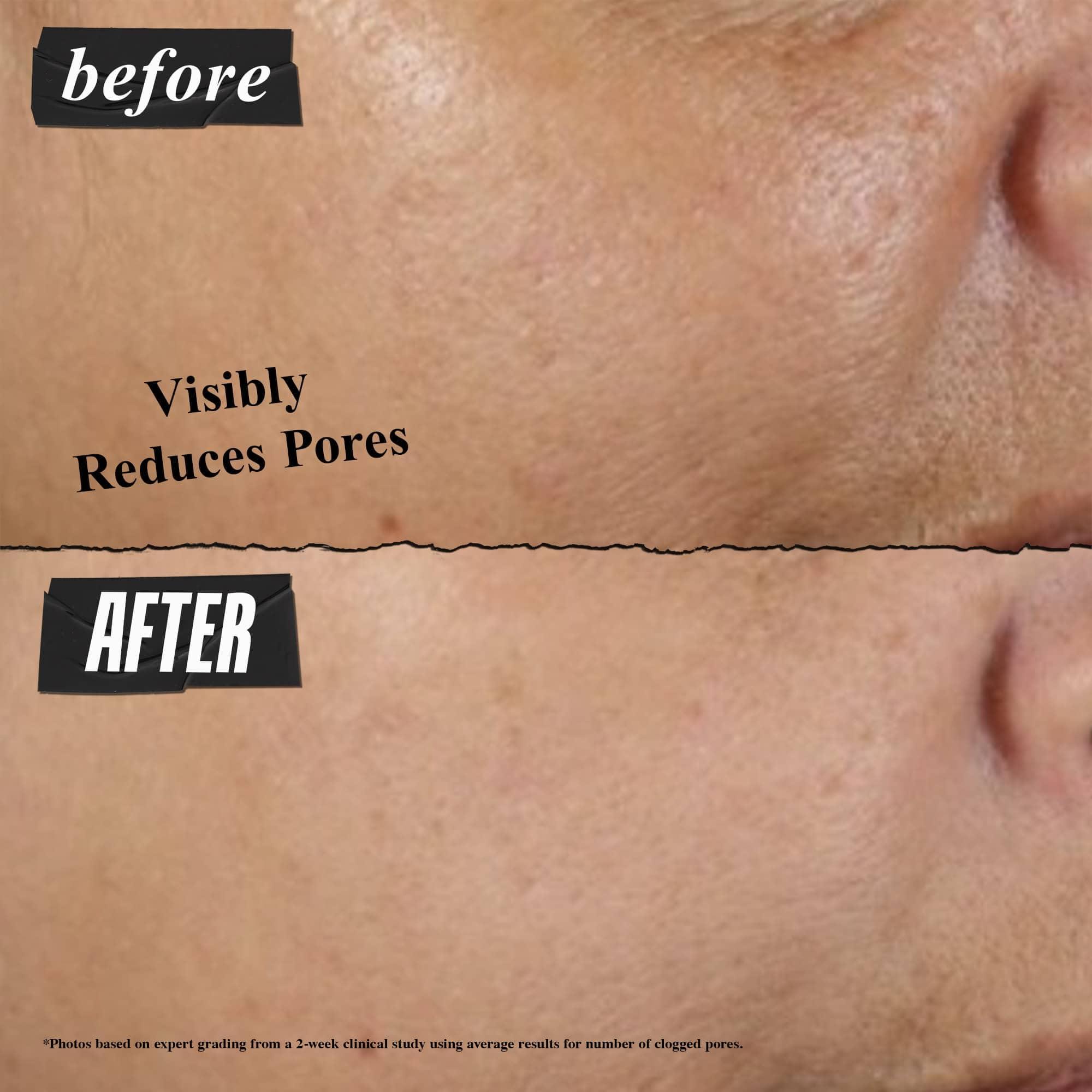 Kiehl's Kiehl\'s Rare Earth Deep Pore Cleansing Mask, Pore-Minimizing Face Mask for Clogged Pores, Detoxifies & Refines Skin, Absorbs Excess Oil, with Amazonian White Clay & Aloe Vera - 0.95 fl oz