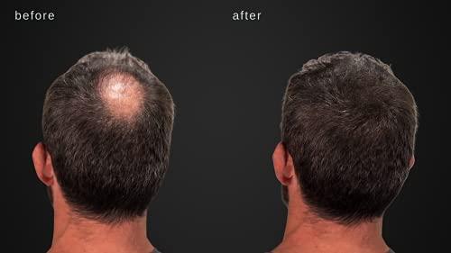 MAXX PRO-SERIES MAXX PRO-SERIES Volumizing Hair Fibers with real Keratin for Thinning Hair/Hair Loss – Dermatologist Tested and Certified Hypoallergenic - 60 days + supply - Multiple Colors Available (Dark Brown)