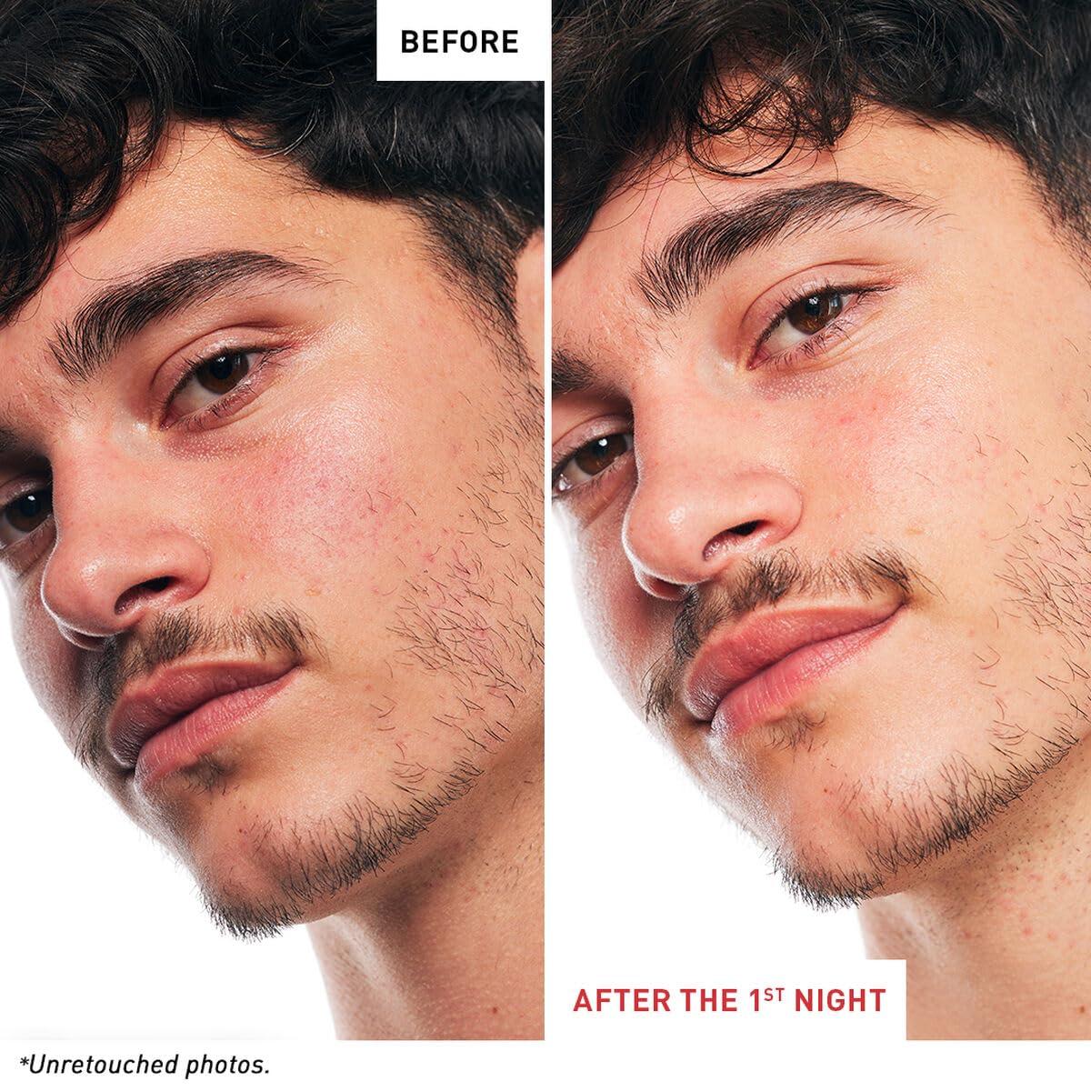 Erborian Skin Therapy Multi-Perfecting Bi-Phase Night Oil-Serum - Supercharged With 17 Ingredients -Targets 7 Skin Concerns- Improves Appearance of Fine Lines, Skin Texture and Complexion Evenness (0.33 Fl Oz)