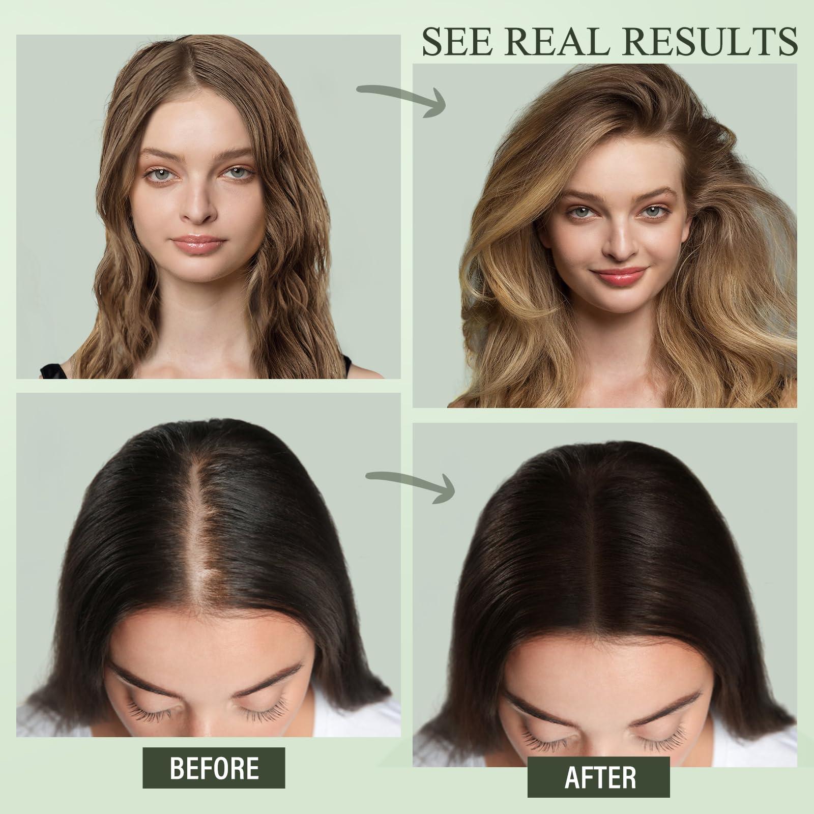 SHVYOG Rosemary Shampoo for Hair Growth, Rosemary Oil Shampoo with Mint and Tea Tree for Hair Loss, Hair Growth Shampoo for Thinning Hair, Suitable for Women and Men 12.17 Fl Oz