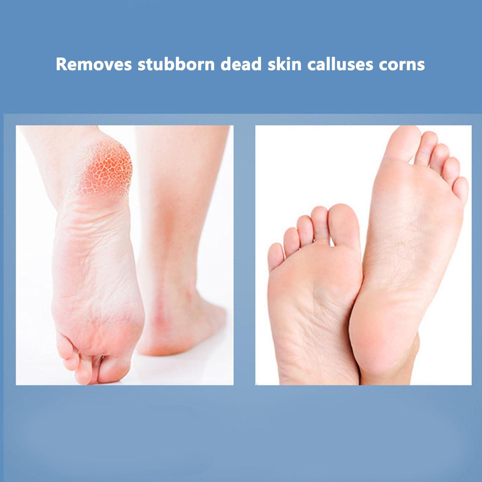 NSXAYIWE 3 in 1 Foot File Callus Remover Scrubber Kit, Stainless Steel Pedicure Tool Foot Scrubber Dead Skin Remover, Foot Sander for Home Spa Use