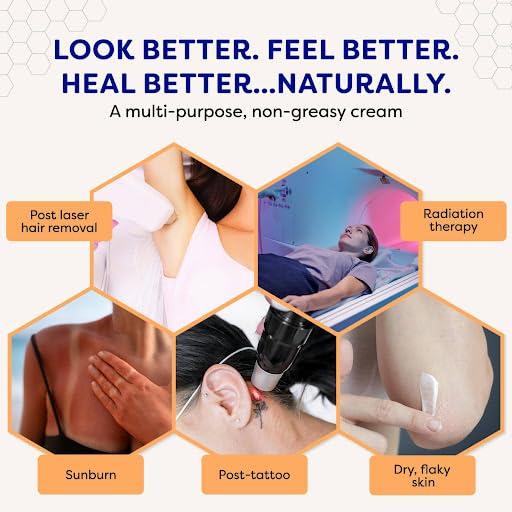 BeeCure BeeCure Radiation Relief and Laser Burn Cream Skin Care Cream, Burn Relief Cream with Buckwheat Honey & Calendula, 60ml Tube