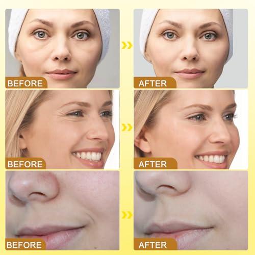 XBEGIX XBEGIX 2pcs Botox Bee Venom Cream - Wrinkle Removal & Firming, Moisturizing, Lifting & Recovery - All Skin Types - Anti-Aging Bee Venom Cream