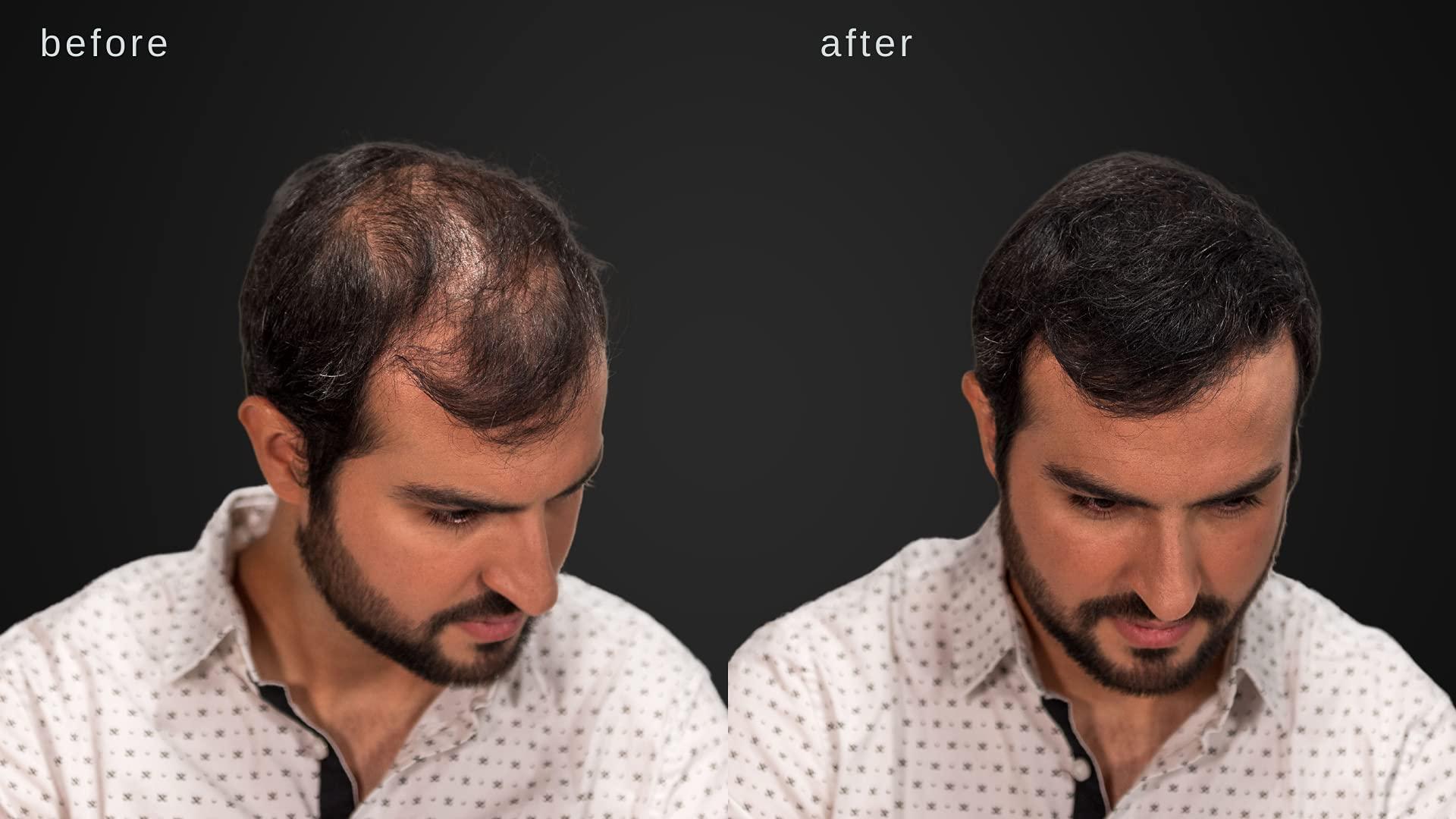 LUXE Professional LUXE Hair Thickening Fibers - CONFIDENCE IN A JAR – 2 Months+ Supply! – Hypoallergenic, Dermatologist Tested – Multiple Colors Available (Dark Brown)