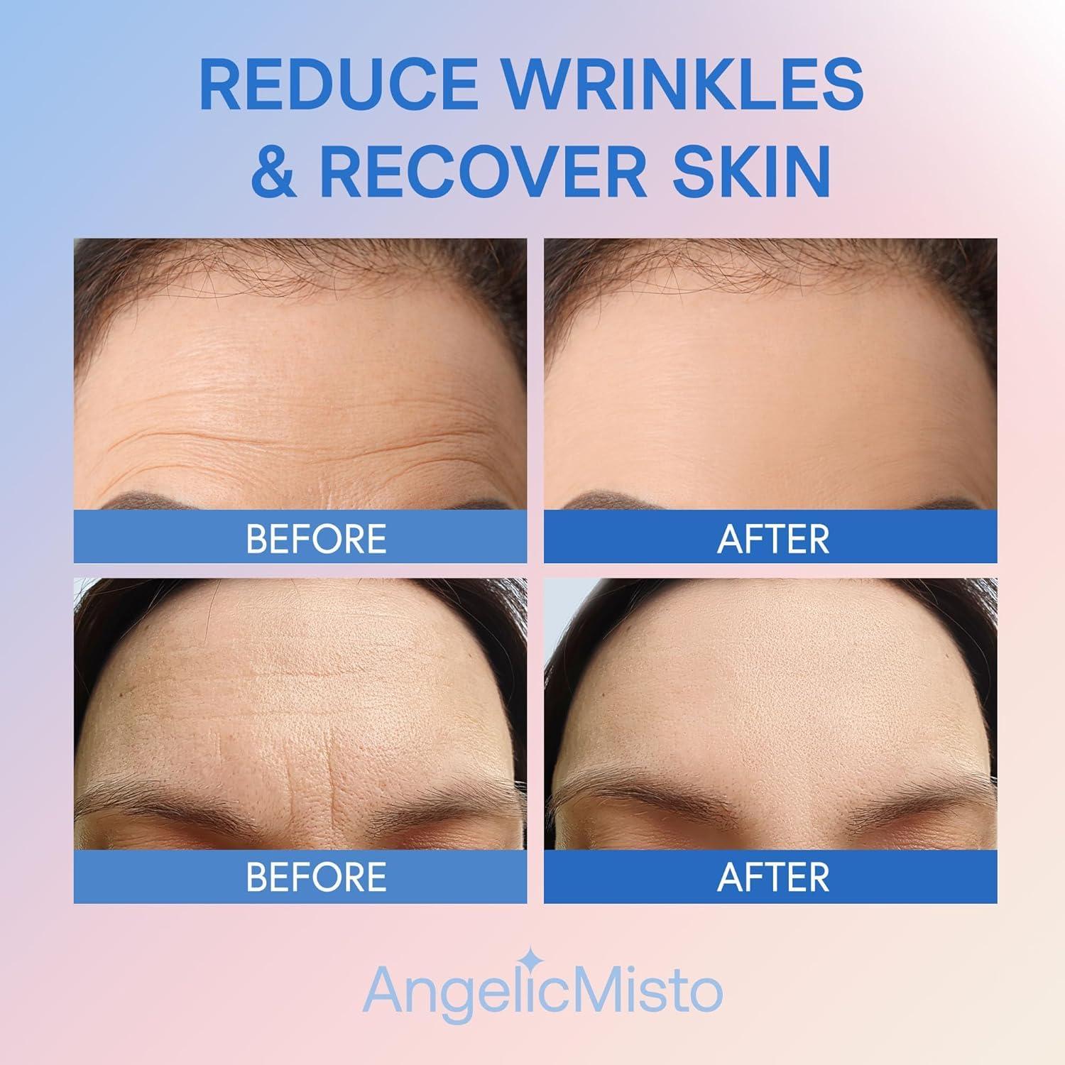 Dersie Dersie Silicone Forehead Wrinkle Patches: Reusable Silicone Anti Wrinkle Patches - Overnight Use for Best Results - 3 PCs