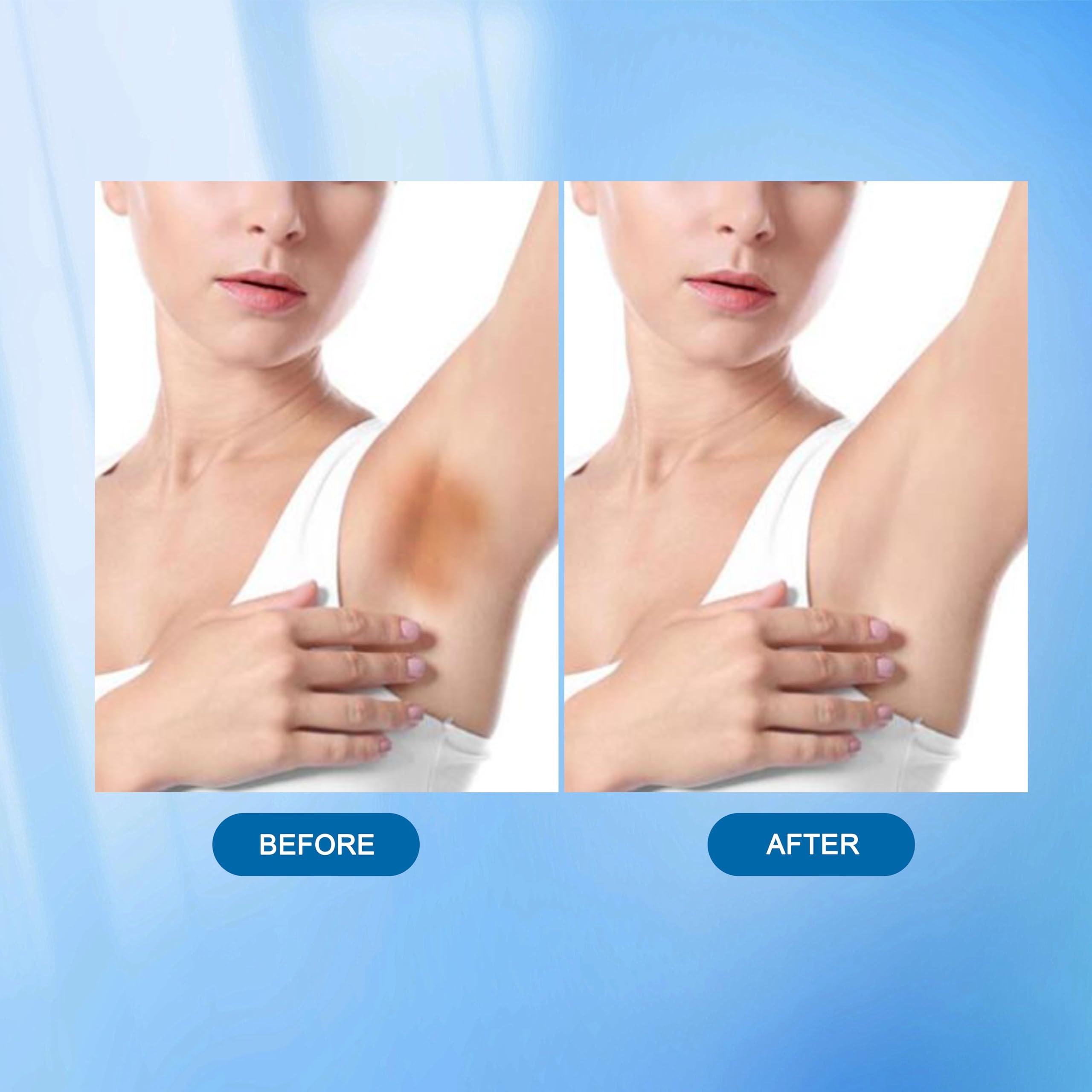 Nirraleza Skin Bleaching Cream for Body Intimate Areas, Skin Whitening Cream, Skin Lightening Cream, Dark Spot Remover for Private Parts, Underarms, Knees, Armpits, Elbows, Inner Thighs (1.7 Fl Oz) (1.7 Fl Oz)