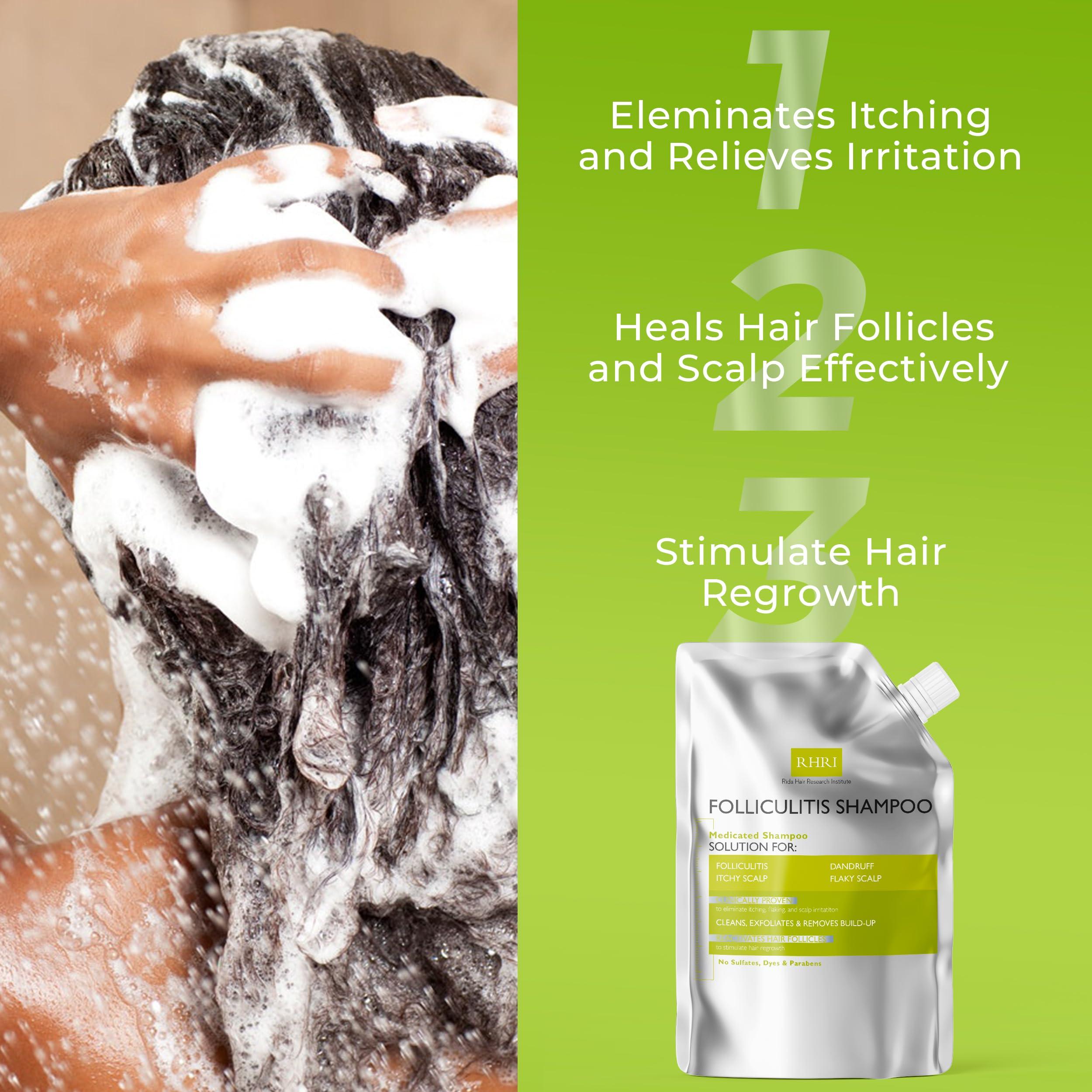 Rida Hair Research Institute Anti Fungal Shampoo for Folliculitis, Seborrheic Dermatitis, Dandruff, Scalp Psoriasis & Itchy Dry Scalp Relief