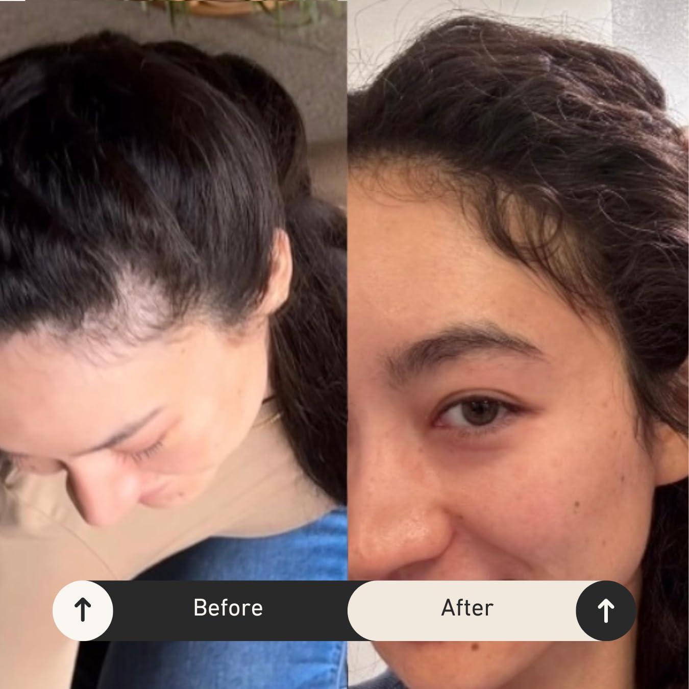 Bur Bur BUR BUR Growing Season Hair Growth And Repair Oil | With Burdock, Nettle Oil and Vitamin C for Visibly Fuller, Stronger and Shinier Hair.