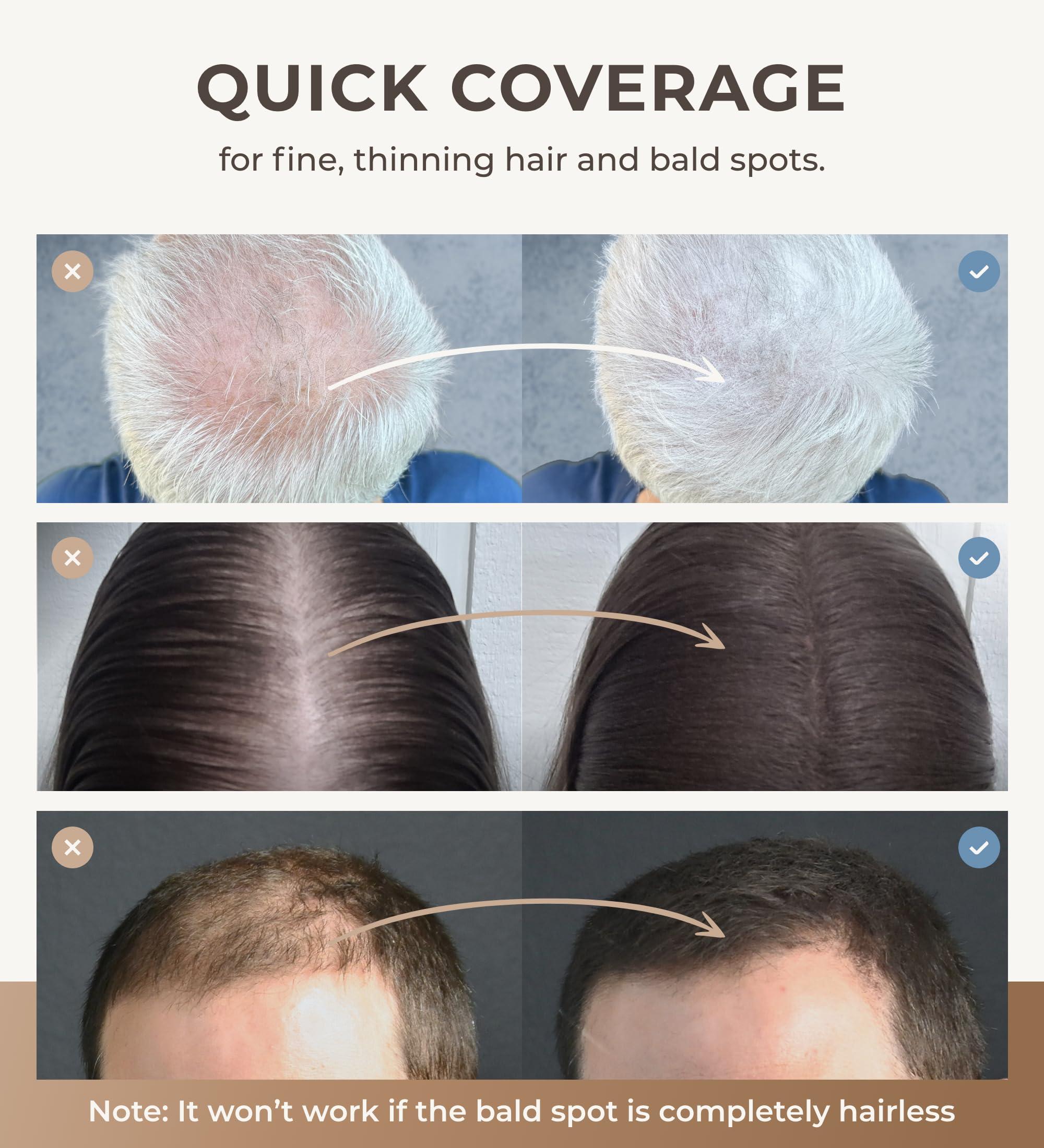 CONFIERR CONFIERR Keratin Hair Fibers for Men & Women - Fill In Fine or Thinning Hair, Instantly Thicker, Fuller Looking Hair (White 30g)