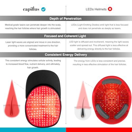 Capillus Capillus Plus Mobile Laser Therapy Cap for Hair Regrowth, with 202 Red Light Lasers for Laser Hair Growth, Red Light Hair Growth