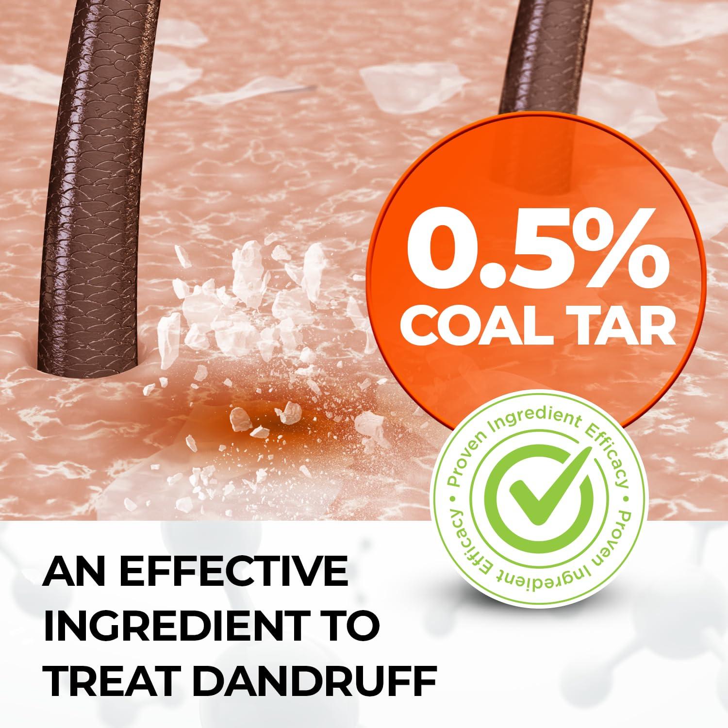 Medicasp Medicasp Coal Tar Gel Dandruff Shampoo to Treat Seborrheic Dermatitis Psoriasis, 6 Ounce (Pack of 1)