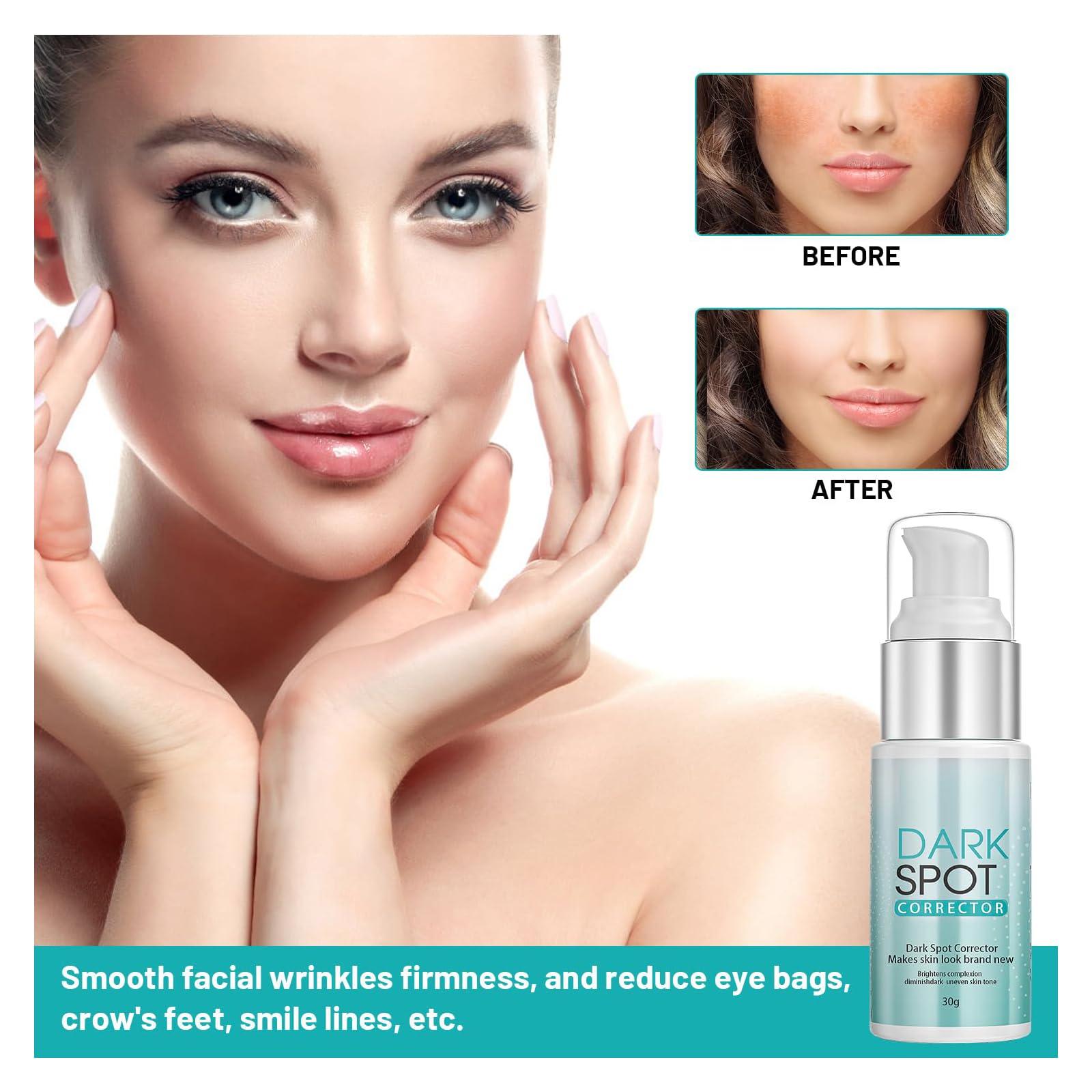 generic Dark Spot Remover for Face And Body, Dark Spot Remover (1)