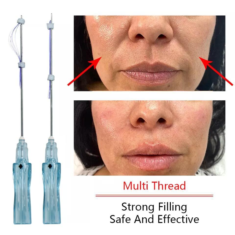 Oldream Oldream Pdo Multi Threads for Face Lift, L-Type, 23G38MM, 20pcs