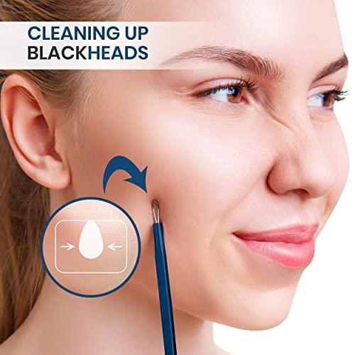 Utopia Care Utopia Care - Professional Blackhead and Blemish Remover - Pimple Comedone Removal 2-in-1 Extractor Tool - Spectrum Blue