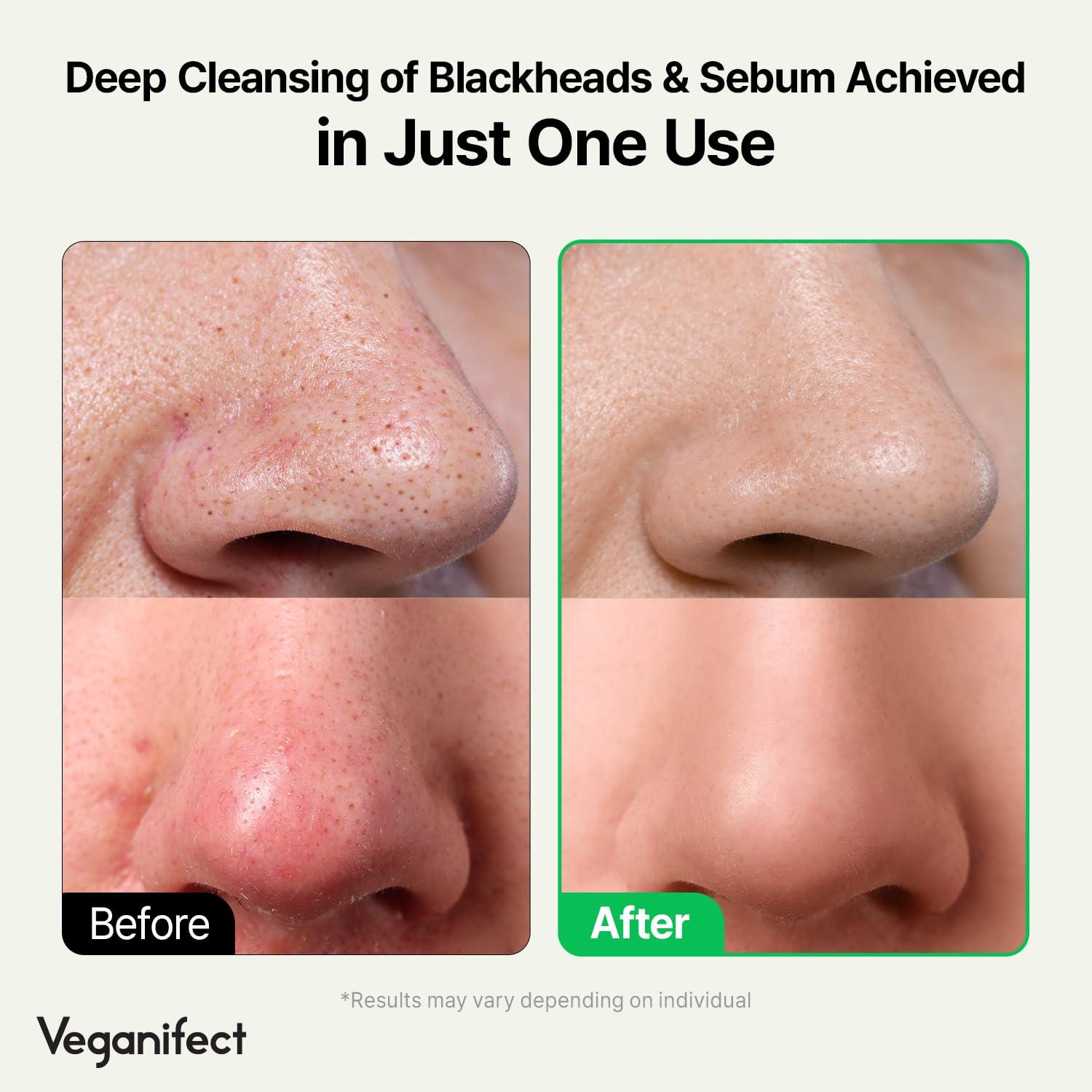 VEGANIFECT VEGANIFECT LHA Deep Cleansing Oil, Makeup, Blackhead and Whitehead Remover, Korean Skin Care, Vegan, 6.93 Fl Oz