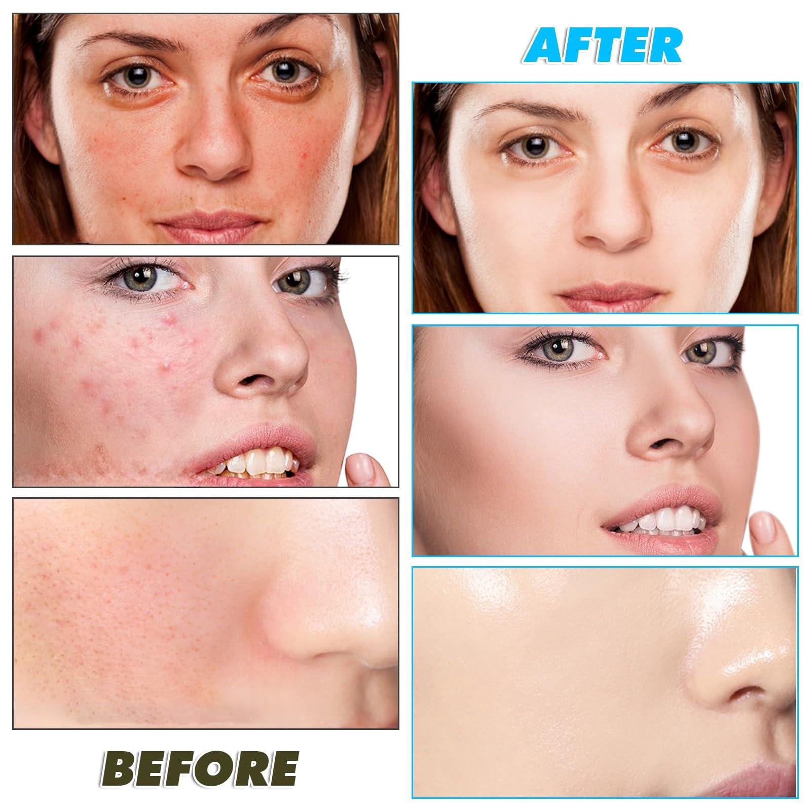 Joanssore 80 Pads Turmeric Cleansing Pads for Face, Turmeric Exfoliating Face Scrub Pads, Turmeric Face Exfoliating Pads with Vitamin C, Turmeric Face Scrub Pads, Infused with Glycerin, B5