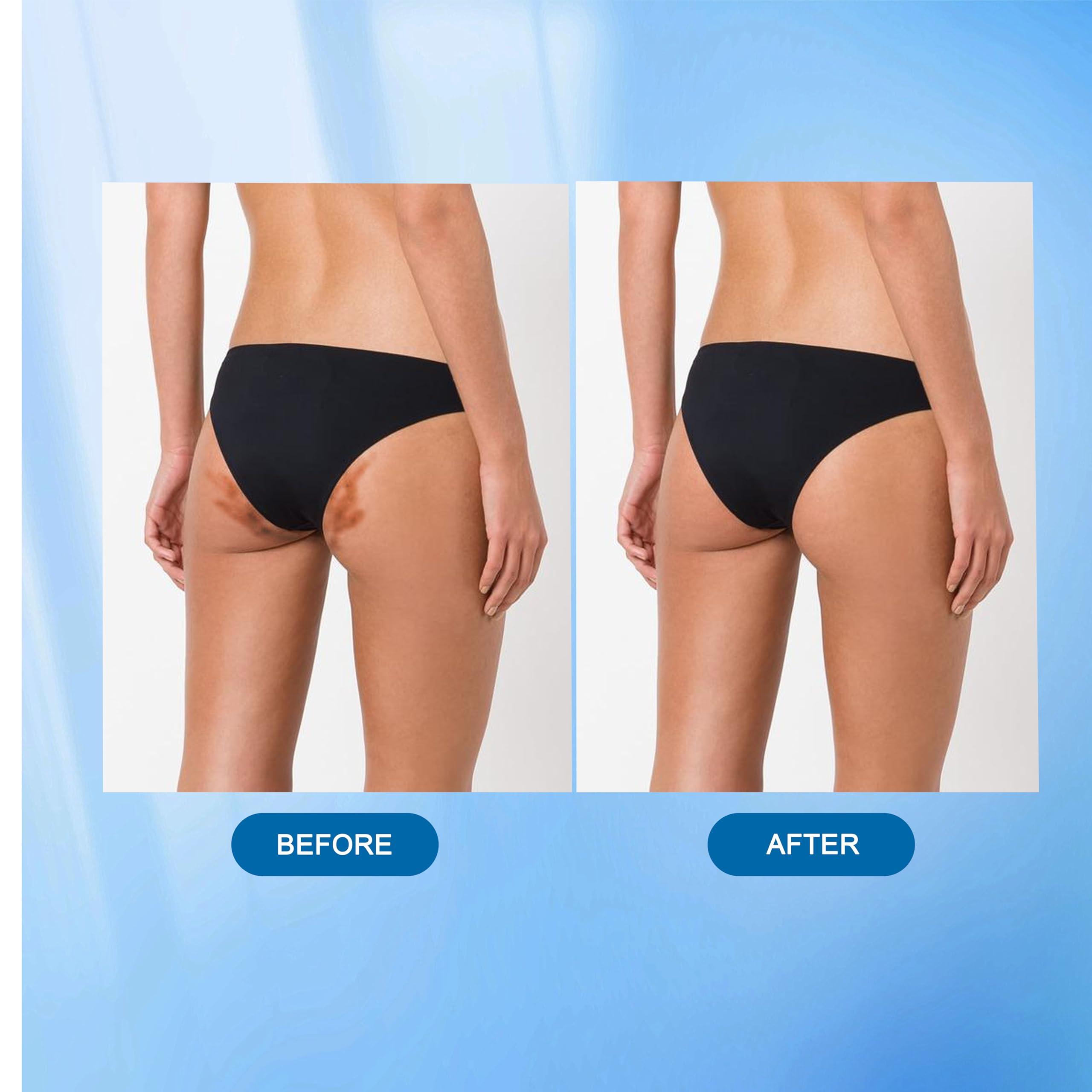 Nirraleza Skin Bleaching Cream for Body Intimate Areas, Skin Whitening Cream, Skin Lightening Cream, Dark Spot Remover for Private Parts, Underarms, Knees, Armpits, Elbows, Inner Thighs (1.7 Fl Oz) (1.7 Fl Oz)