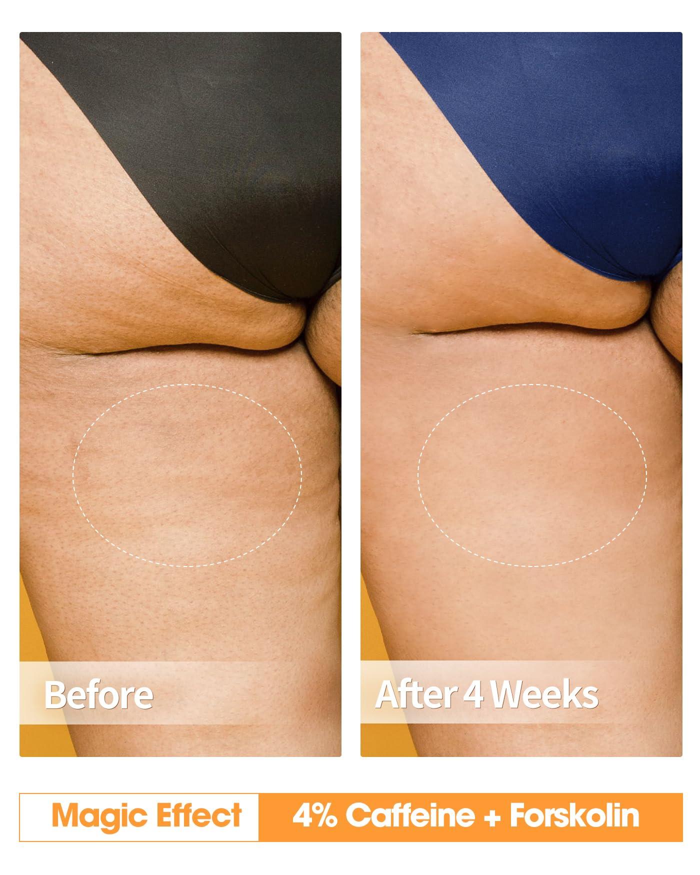 TTLALA Anti Cellulite Cream for Butt and Thighs, Hot Cream with 2% Caffeine and Forskolin, B Flat Belly Firming Cream and Skin Tightening Cream for Skin Firming, Moisturizing 5.4 oz