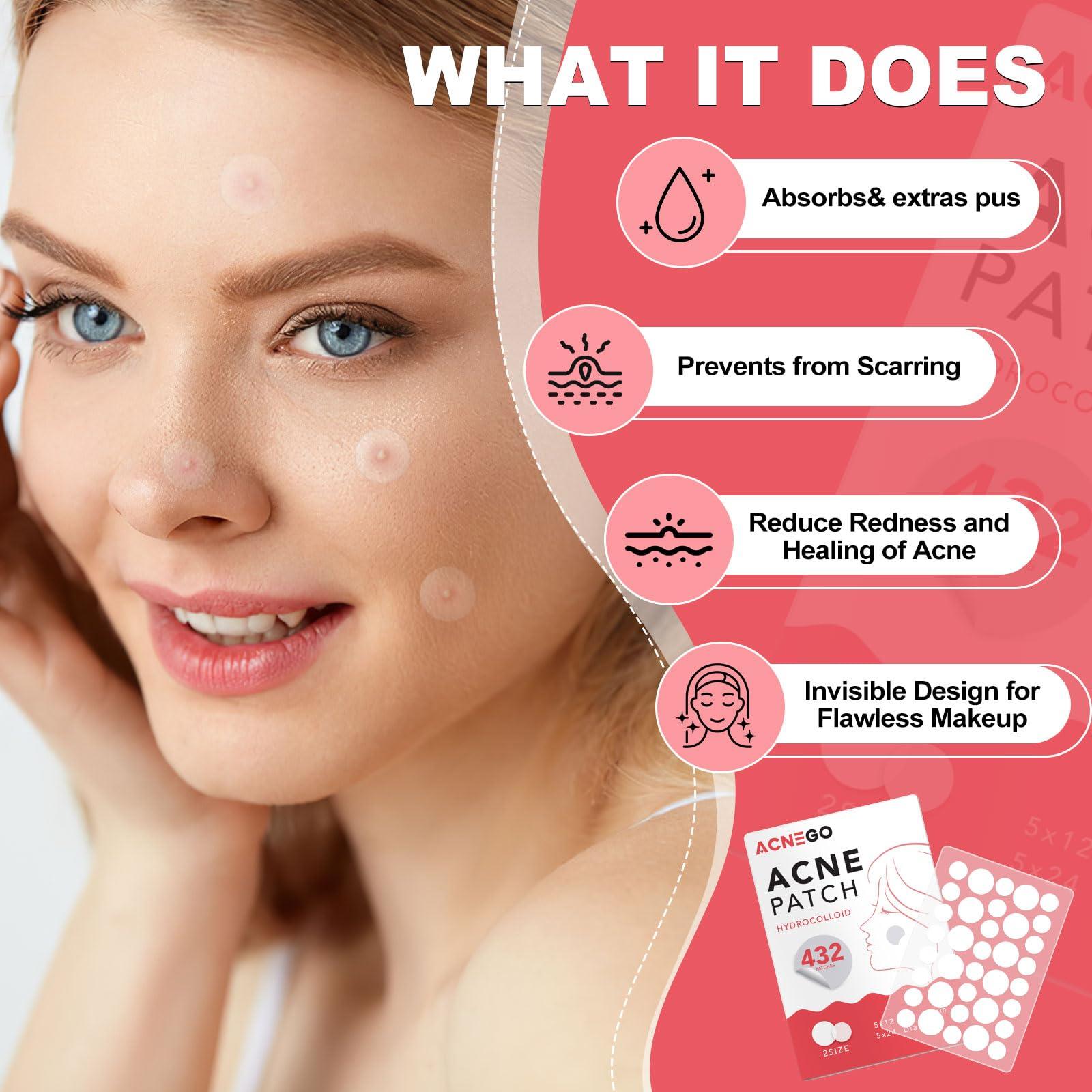 Beavorty Beavorty 15 Pcs Broken Hair Stickers Bangs Stickers Hair Clips for Styling Hair Bang Patch Hair Bang Pad Hair Pads Holders Letter Sticker Makeup Accessories Polyester Modeling Securing Clip