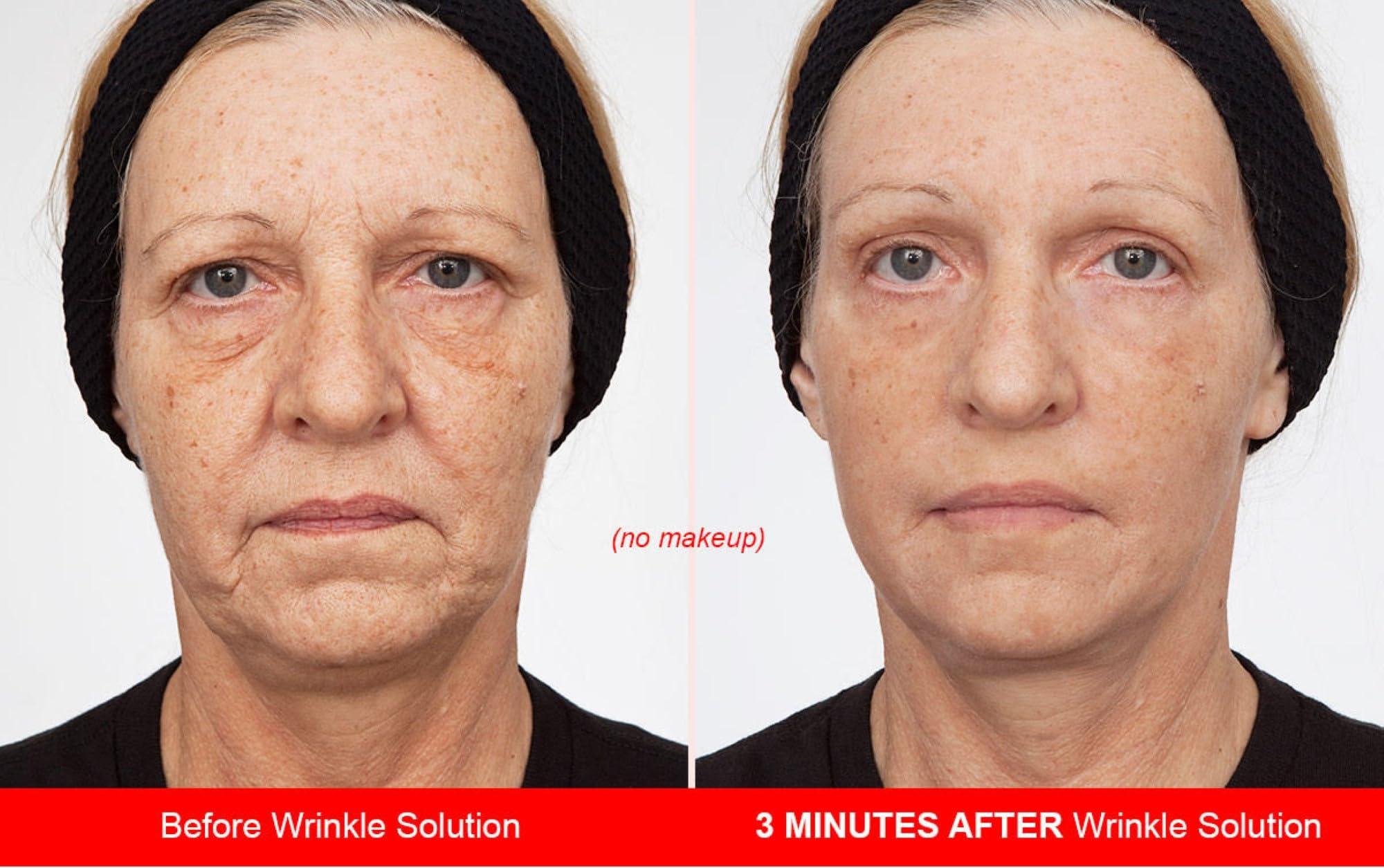 Dr.Sevinor Skincare Solutions Dr Sevinor Genuine Wrinkle Solution Wrinkle Smoothing Tinted Serum and Dr. Sevinors NEW Genuine Facelift Solution Concentrated Serum Invigorates Tired Looking Skin, Diminishes Wrinkles/Lines