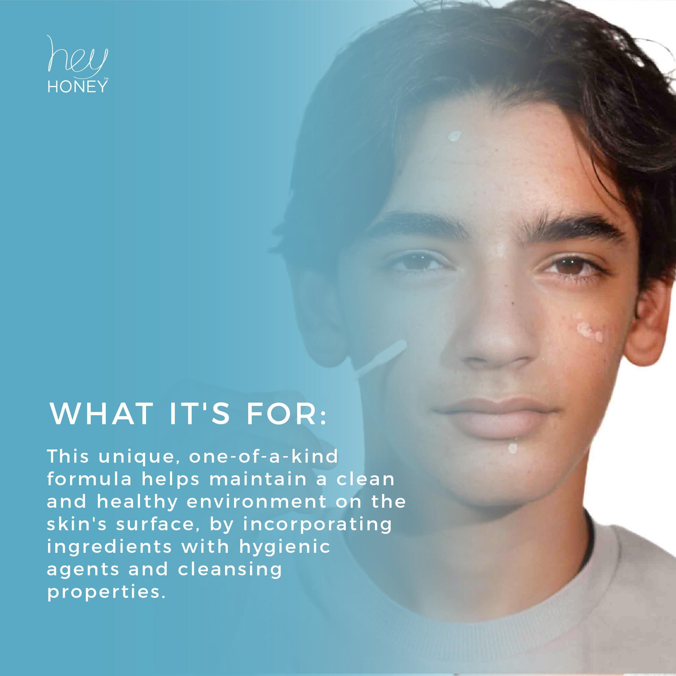 Hey Honey Hey Honey Skincare Be Clear - Acne Spot Treatment Overnight, Pimple Drying Lotion, Use Over Zits Whitehead & Blemishes 1 OZ