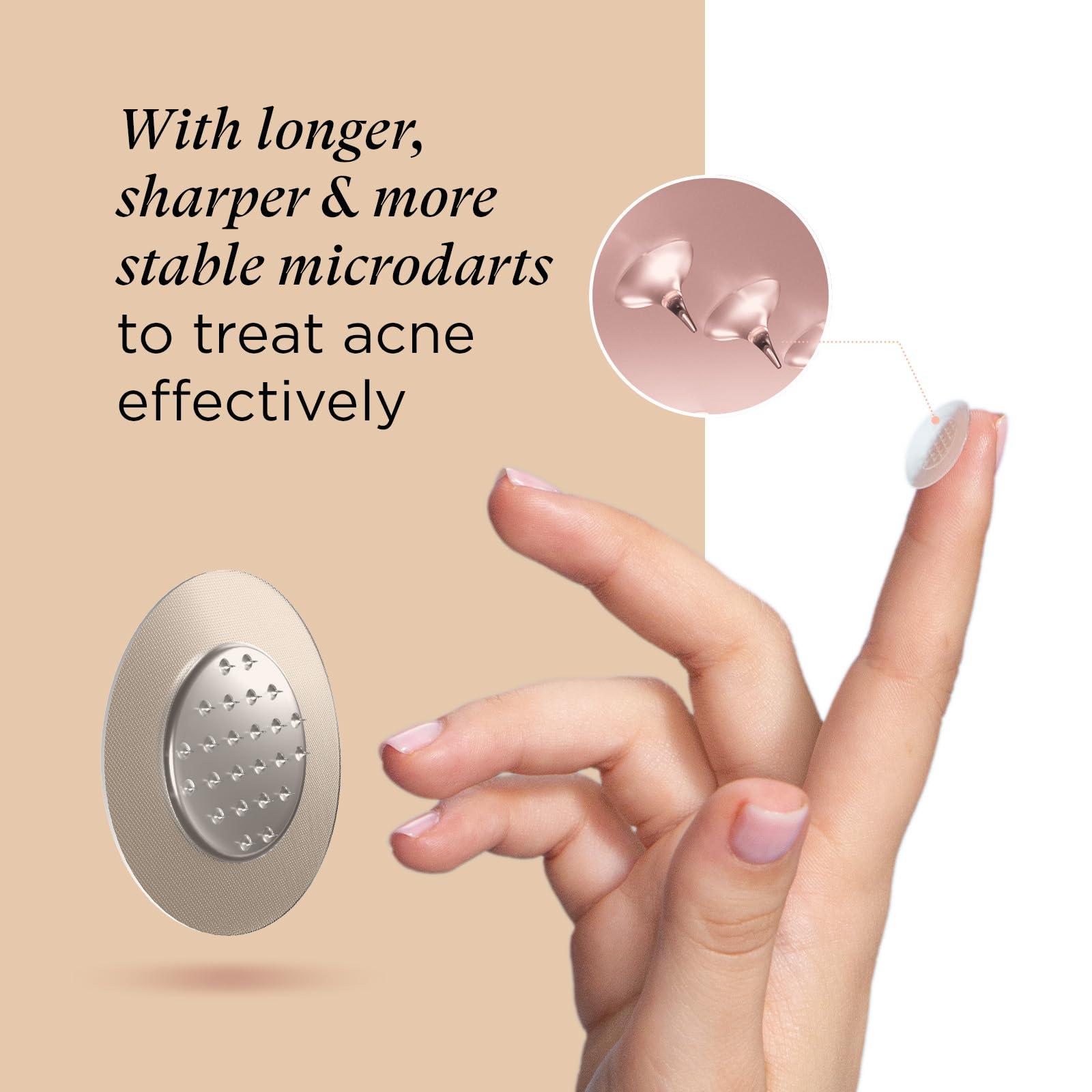 ZitSticka ZitSticka Extra Strength Killa Acne Patches for Face - World\'s Most Potent Pimple Patch with Fast-Acting Microdarts - Starts Working within 2 Hours for Deep, Early-Stage Zits & Blemish - 4 Count