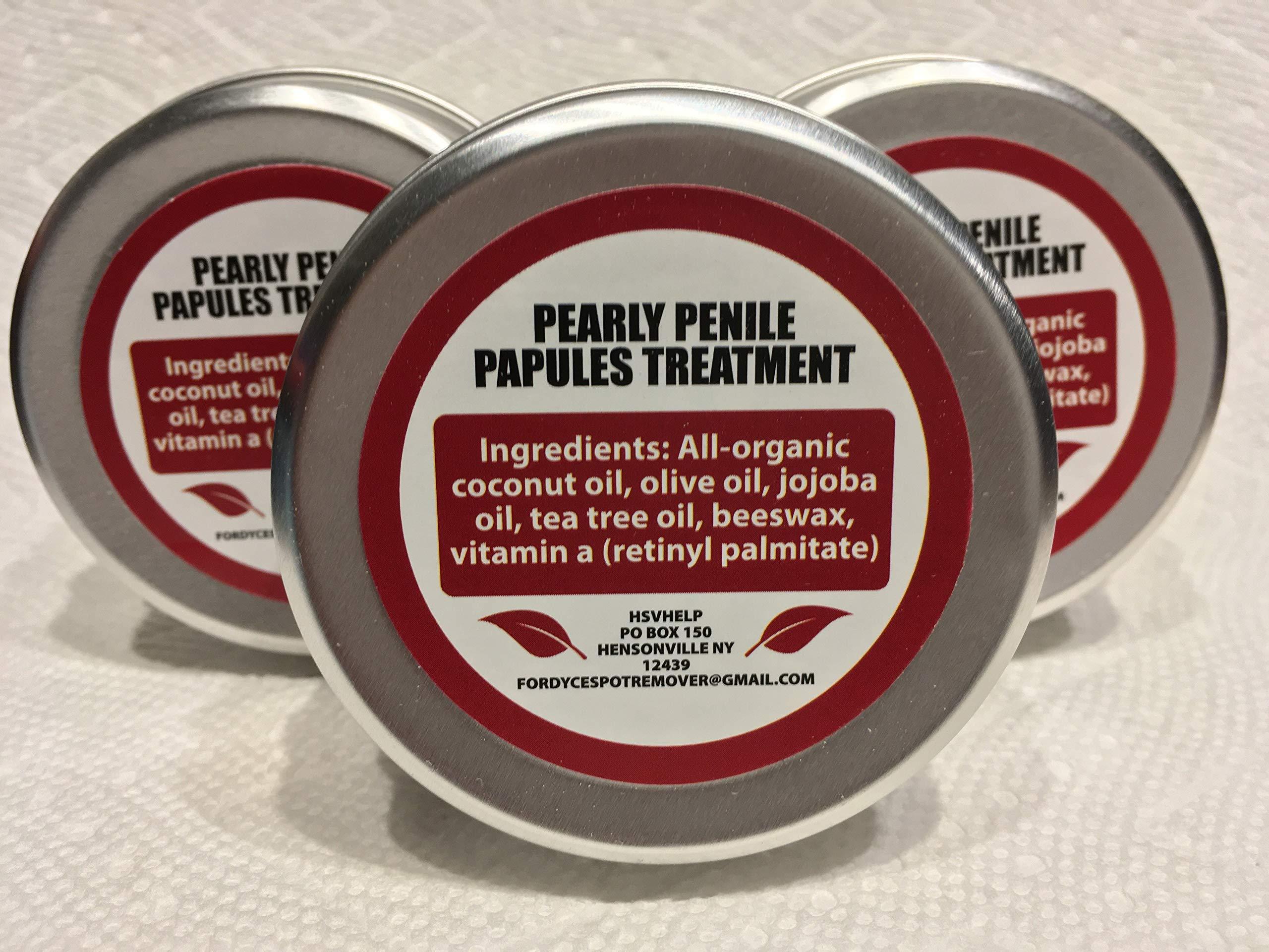 HSVhelp Pearly Penile Papules Removal Cream Pearly Penile Papules Removal Cream - Fordyce Spots treatment for Pearly Penile Papules