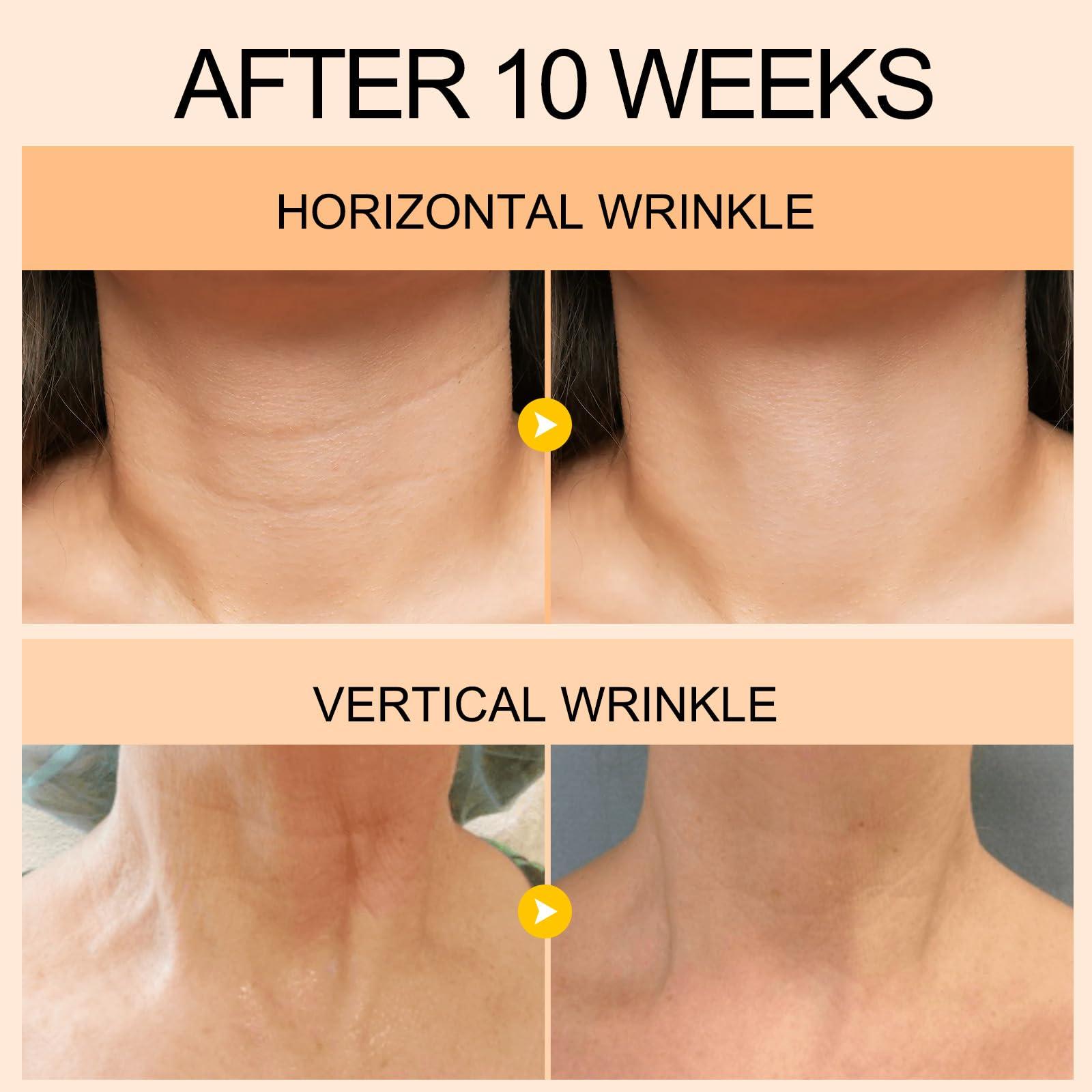 LA.PERSONAL LA.PERSONAL Neck Firming and Tightening Serum and Dark Spot Corrector