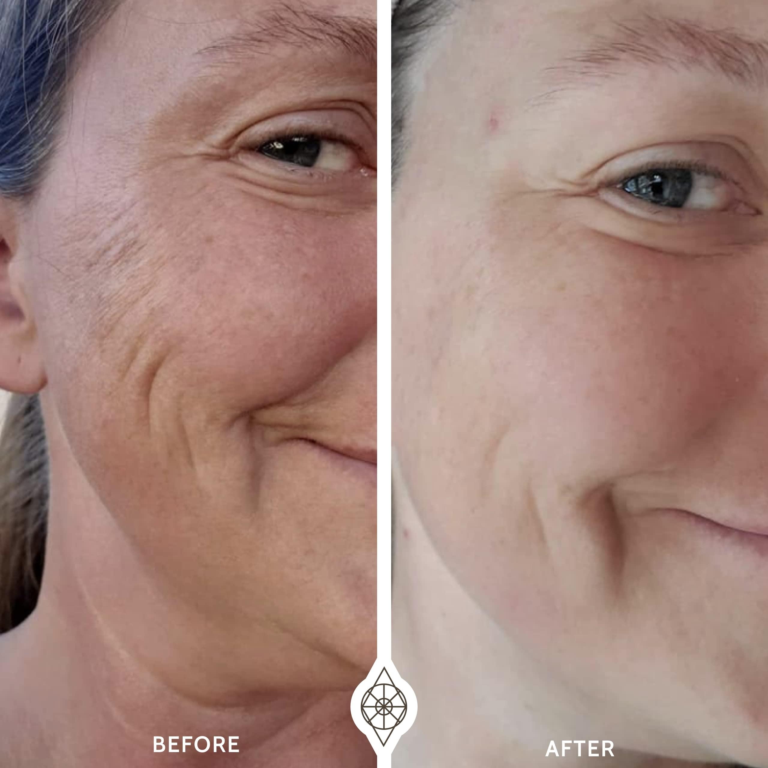 FasciaBlaster The OMG Blaster 5-in-1 Face Lifting Tool by Ashley Black. Patented Technology for Fine Lines, Wrinkles, Skin Tightening, Face Contouring, Lymphatic Darinage and Temporary Blood Flow