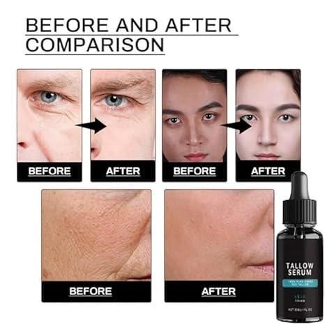 EEGCUPD Forge Wrinkle Defense Tallow Balm, Forge Beef Tallow Skin Care for Men, Forge Mens Face Care Set, 2024 New Skin Care for Men TallowMens Anti Wrinkles Anti Aging Facial Care Kit (1set)