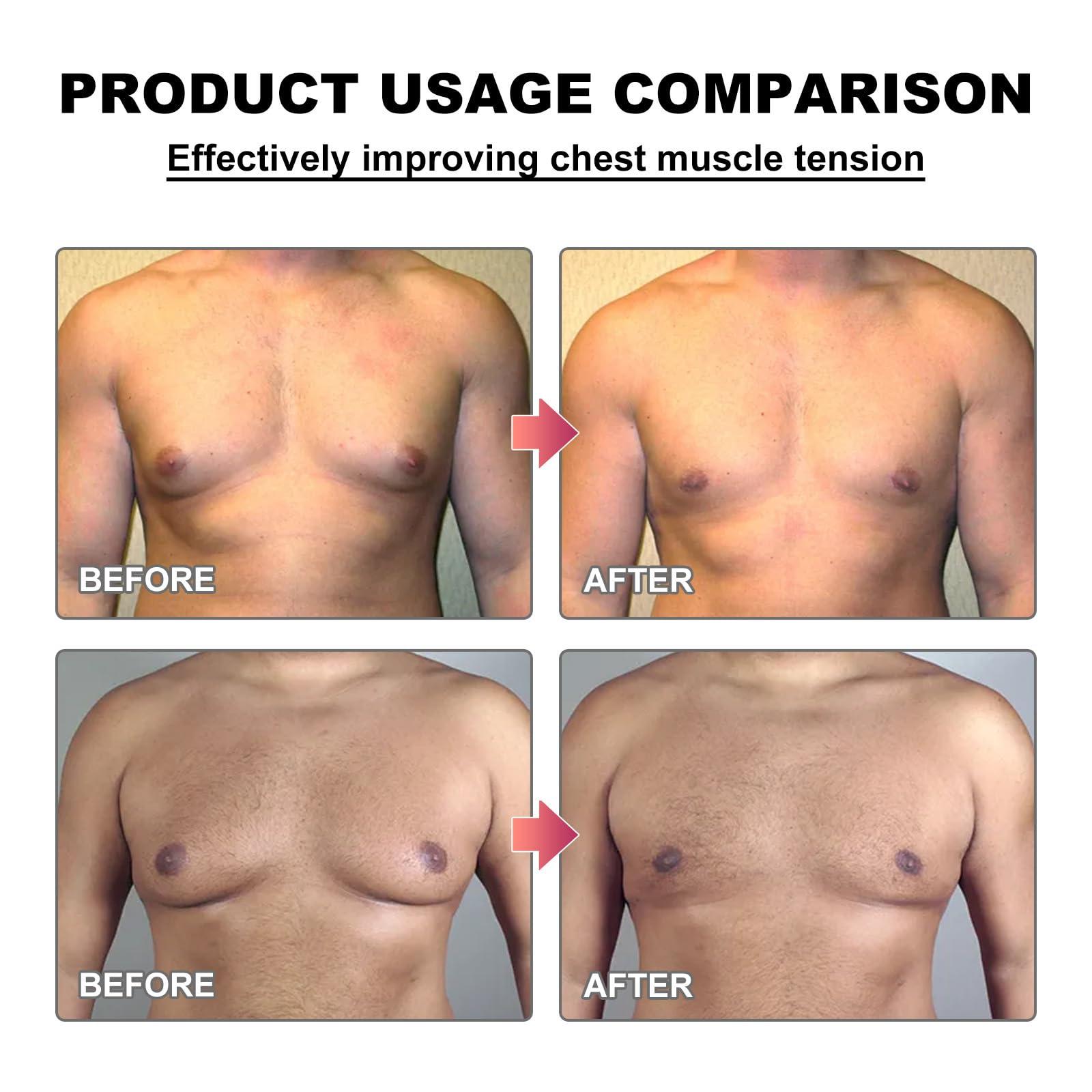 Generic Generic Men Therm Bee Venom Gynecomastia Heating Oil, Men Therm Bee Venom Oil, Mentherm Heating Oil, Gynecomastia Tightening Oil for Men, Men Contouring Treatment Oil (1pcs)