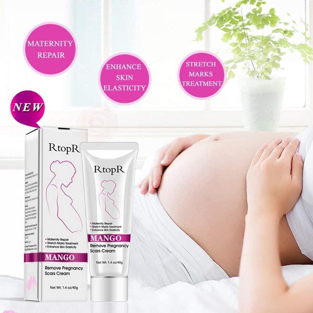 MQUPIN RtopR Mango Stretch Marks and Scar Cream -Stretch Marks and Scar Removal Cream for Pregnancy - Best Body Moisturizer-40g