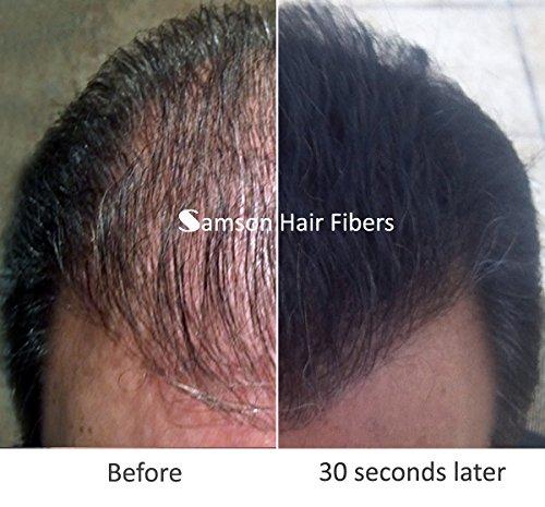 SAMSON HAIR FIBERS Samson Hair Fibers for Thinning Hair - 100% Undetectable Natural Formula - Completely Conceals Hair Loss in Seconds. Covers bald spots. Thicken your hair instantly - 25 Grams Refill (MED. BROWN)