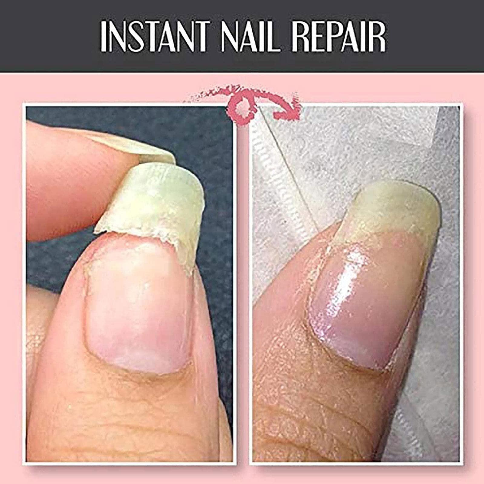 PLGEBR PLGEBR Nail Repair Protection Gel Mottled Nail Repair Protection Gel 10ml (10ml*2pcs, Top coat)