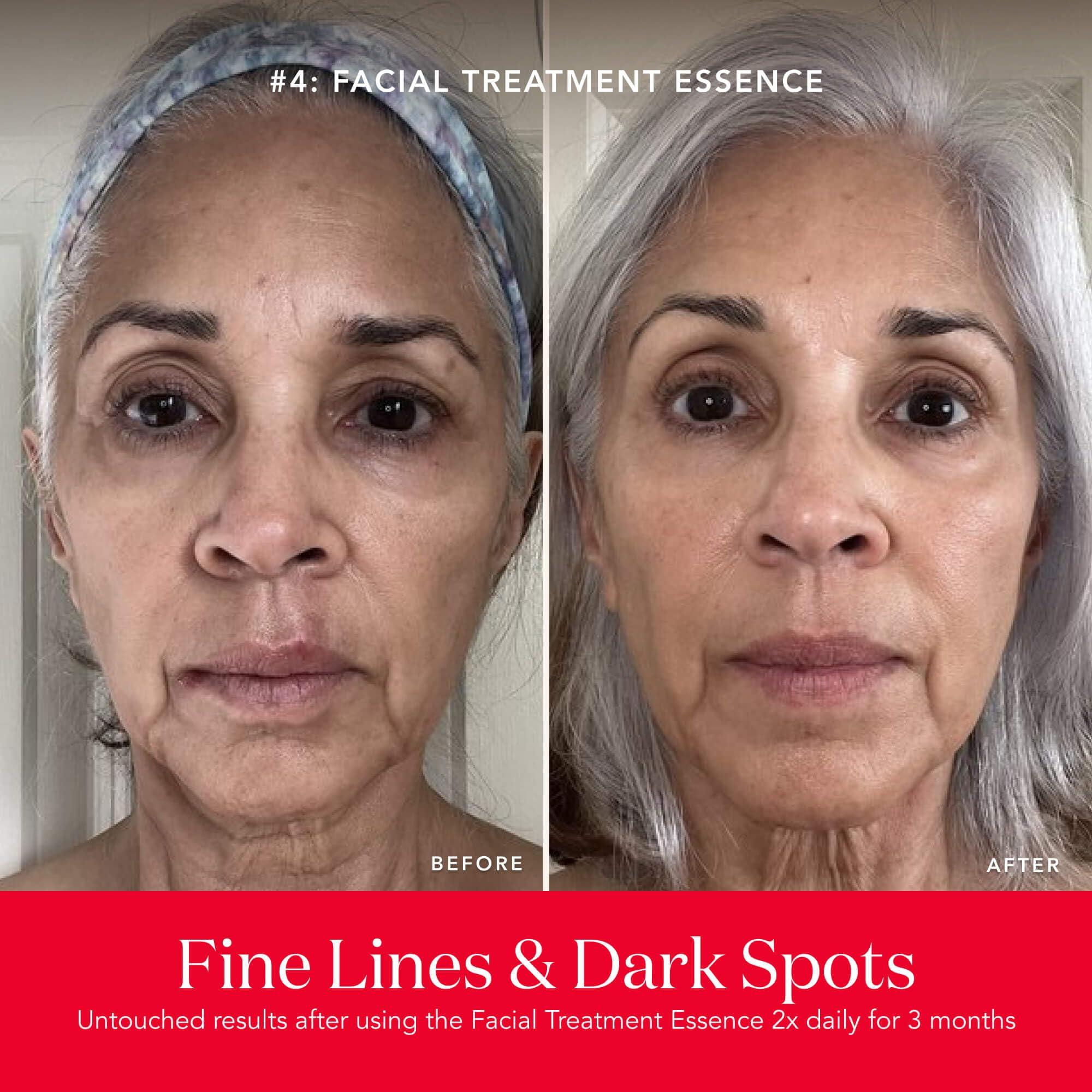 SK-II SK-II Best Sellers Skincare Gift Set - Anti Aging Skincare Set Includes Full Size Facial Essence, Travel Size Cleanser, Toner & Face Cream & 2 Sheet Masks (6 Count)