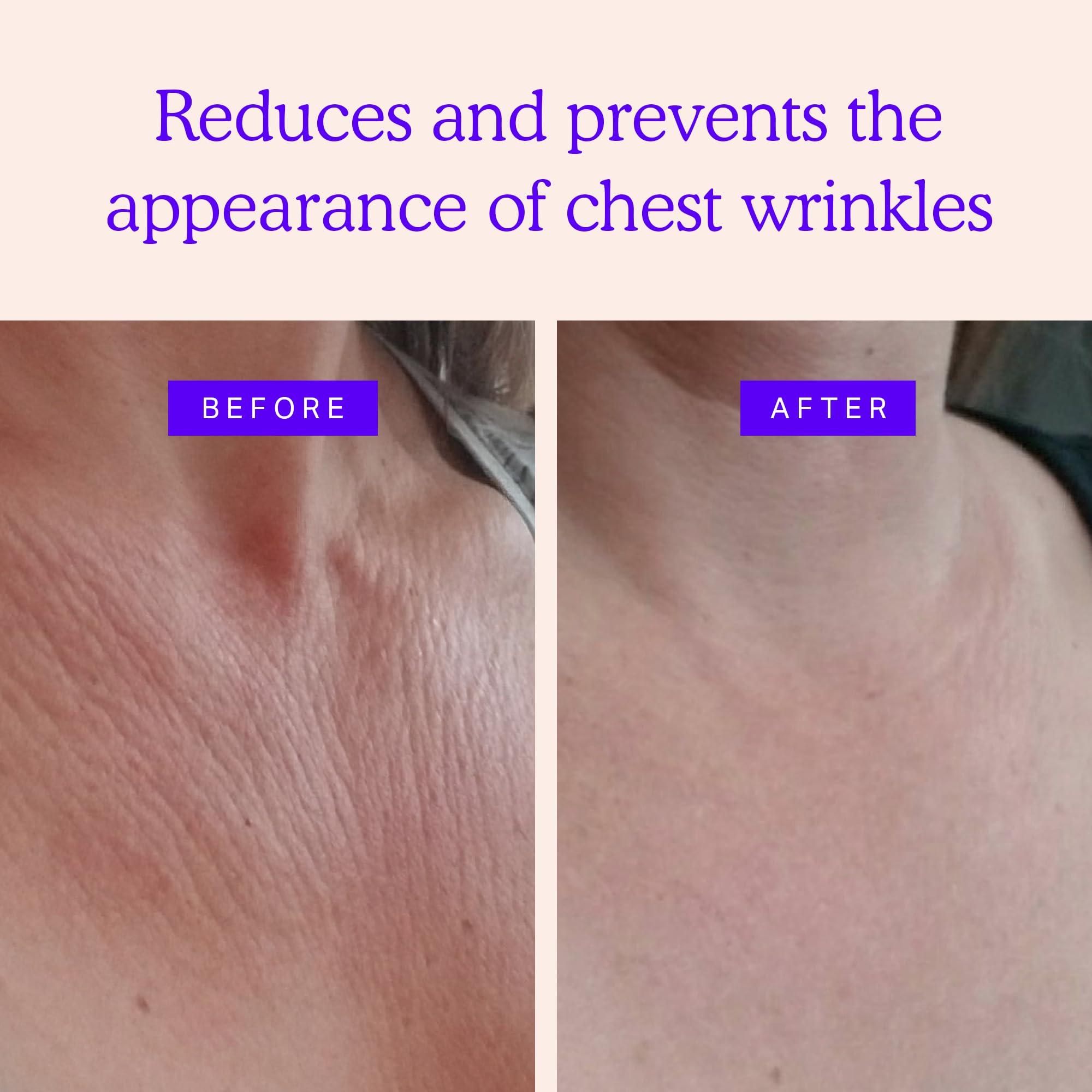 BLUMBODY BLUMBODY Chest Wrinkle Pads and Face Wrinkle Patch Minis Bundle