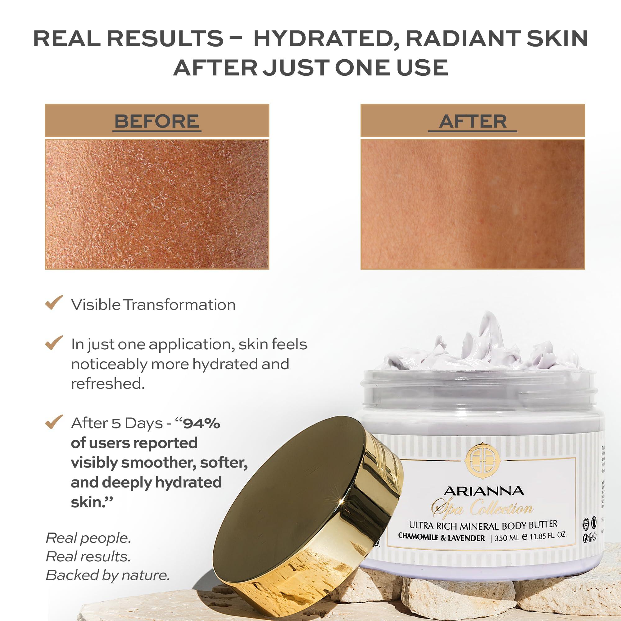 ARIANNA ARIANNA-SKINCARE Ultra Rich Mineral Body Butter Dead Sea Body Butter For Dry Skin Repair Rich Vegan Hydrating Moisturizer (Milk & Honey)