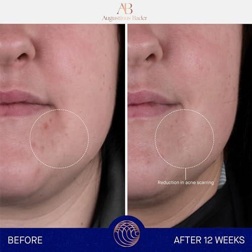 Augustinus Bader Augustinus Bader The Rich Cream 50ml