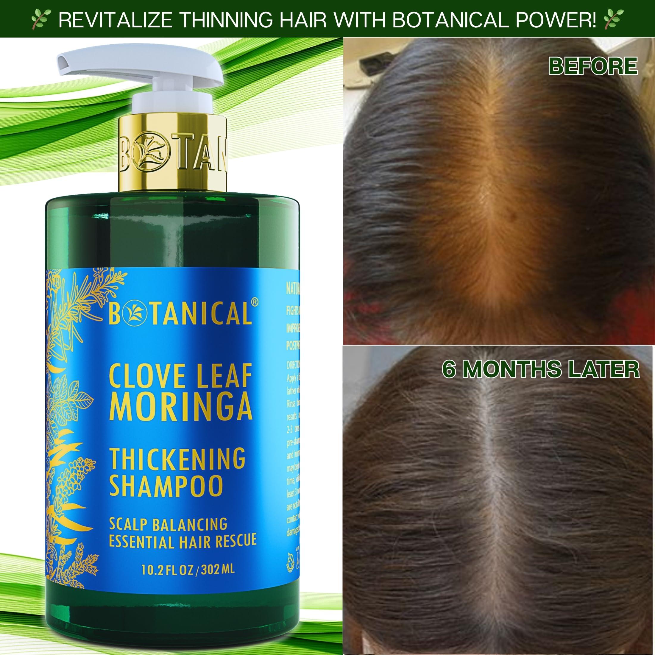 BOTANICAL HAIR GROWTH LAB Botanical Hair Growth Moringa Shampoo With Saw Palmetto For Hair Loss and Hair Thinning Prevention Scalp Balancing Natural Thickening Shampoo Regrowth Products For Women & Men 10.2 Fl Oz
